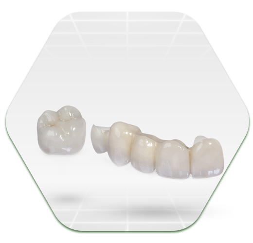 Sứ Zirconia