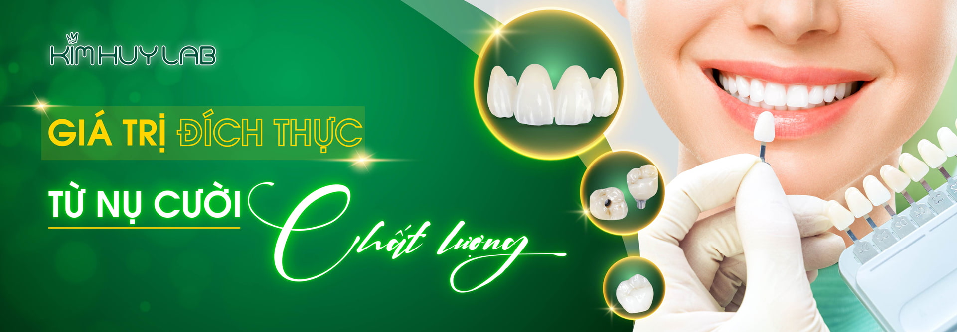 Giá trị đích thực từ nụ cười xinh